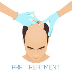 prp-treatment